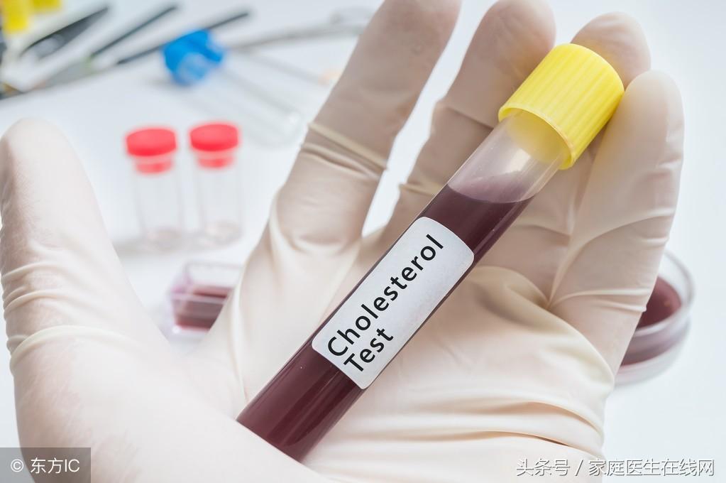 糖尿病的成因，深度解析其背后的原因，深度解析糖尿病成因，揭示背后原因真相