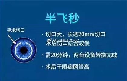 全飛秒和半飛秒哪個更好，深度解析兩種近視矯正技術(shù)的優(yōu)劣，全飛秒與半飛秒近視矯正技術(shù)對比，深度解析優(yōu)劣差異