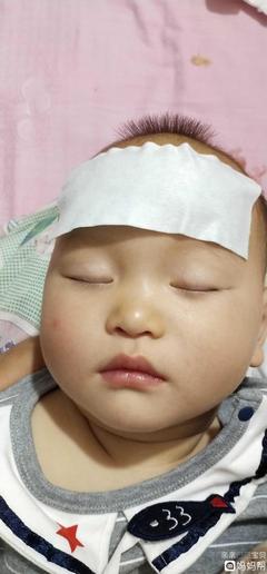 小孩子發(fā)燒39度怎么退燒最快？全面指南與關(guān)鍵措施，全面指南，兒童高燒39度快速退燒方法與關(guān)鍵措施