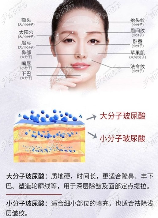 玻尿酸的作用與功效，深入了解玻尿酸的奧秘，玻尿酸的作用與功效揭秘，深入了解玻尿酸的神奇之處