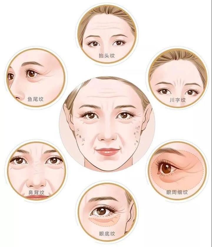 去魚尾紋用什么最好的方法——全面解析抗皺秘訣，去魚尾紋的最佳方法，全面解析抗皺秘訣