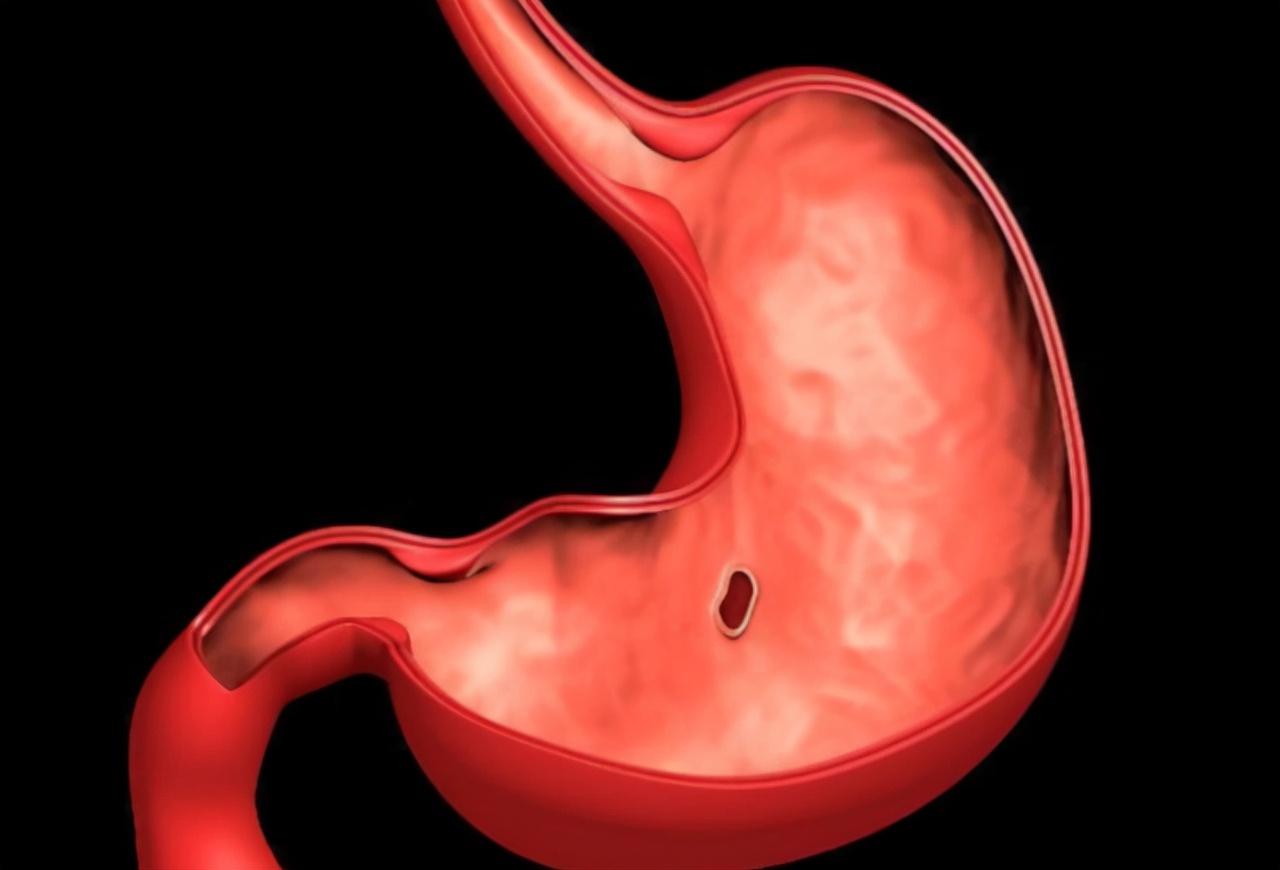 做胃鏡對胃傷害有多大，深入了解與關注，胃鏡對胃的影響，深入了解與關注