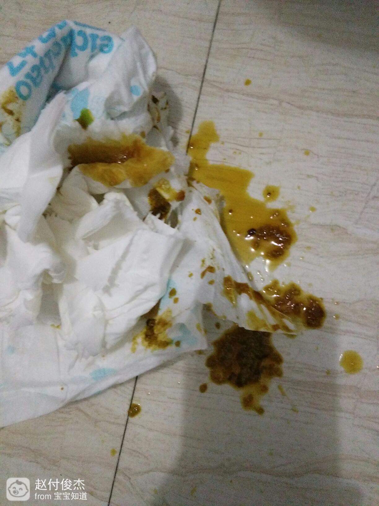 寶寶腹瀉一進食就拉，原因、應對措施與預防方法，寶寶腹瀉，進食即拉的原因、應對措施及預防方法全解析