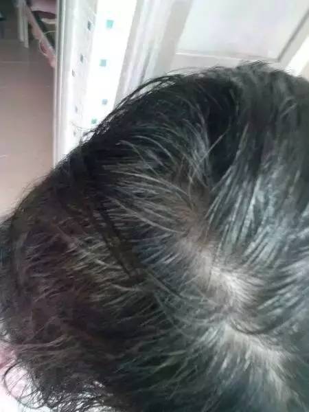 白發(fā)變黑發(fā)最快土法——自然黑發(fā)秘訣大揭秘，自然黑發(fā)秘訣，白發(fā)轉(zhuǎn)黑發(fā)最快土法大揭秘