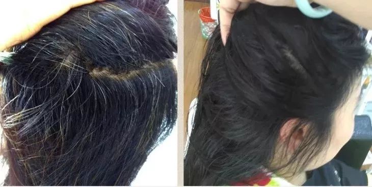 白發(fā)轉(zhuǎn)黑發(fā)，可能性與實(shí)現(xiàn)方法，白發(fā)轉(zhuǎn)黑發(fā)的可能性與實(shí)現(xiàn)方法探討